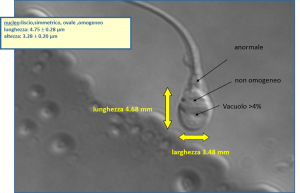 Valutazione della testa del collo dello spermatozoo